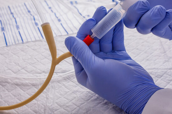 Catheterization