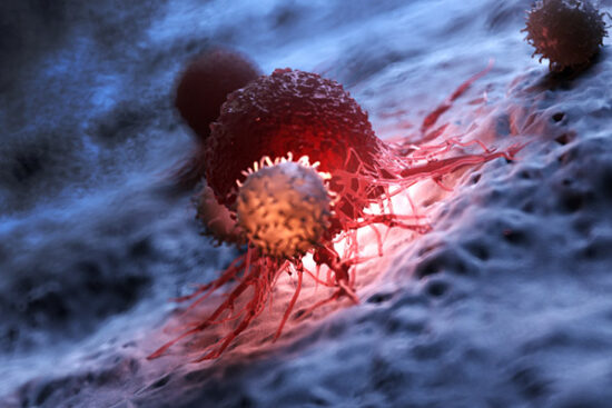Oncology