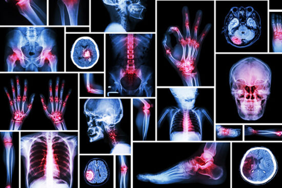 Orthopedic-Surgery