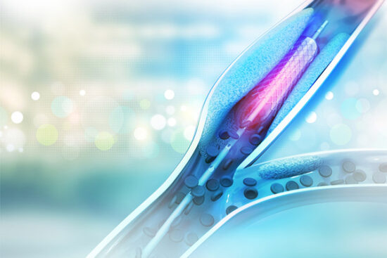 Vascular-Surgery